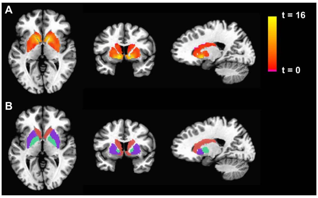 Introduction to Neurohacking In R