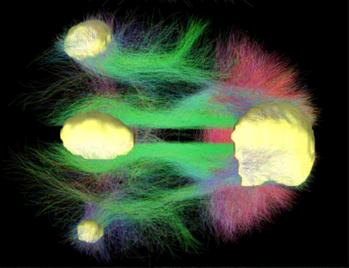 Neurons and Networks