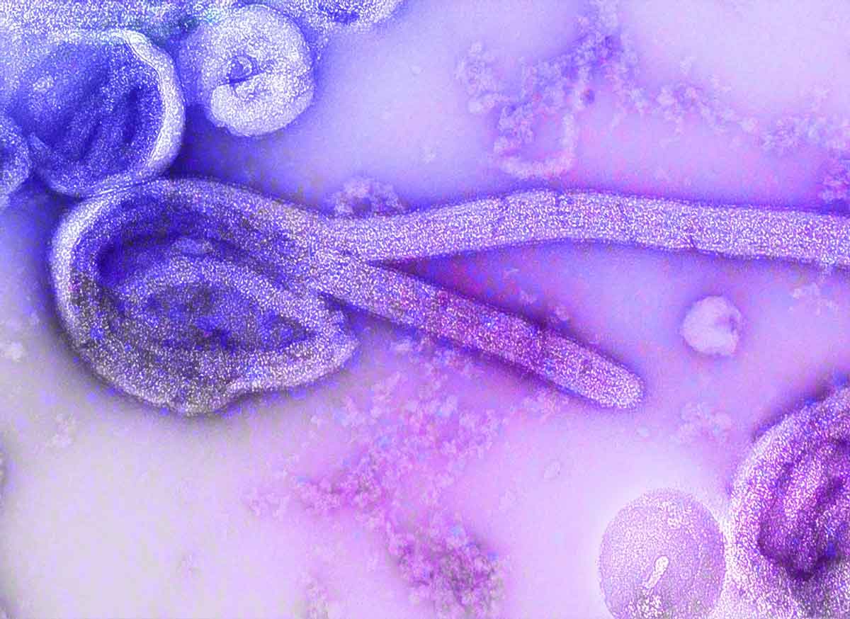 Tropical Parasitology